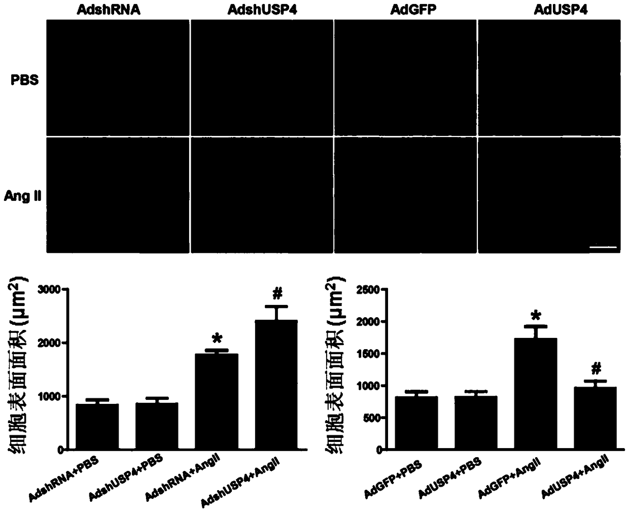 Function and application of ubiquitin-specific protease 4 (usp4) in the treatment of cardiac hypertrophy