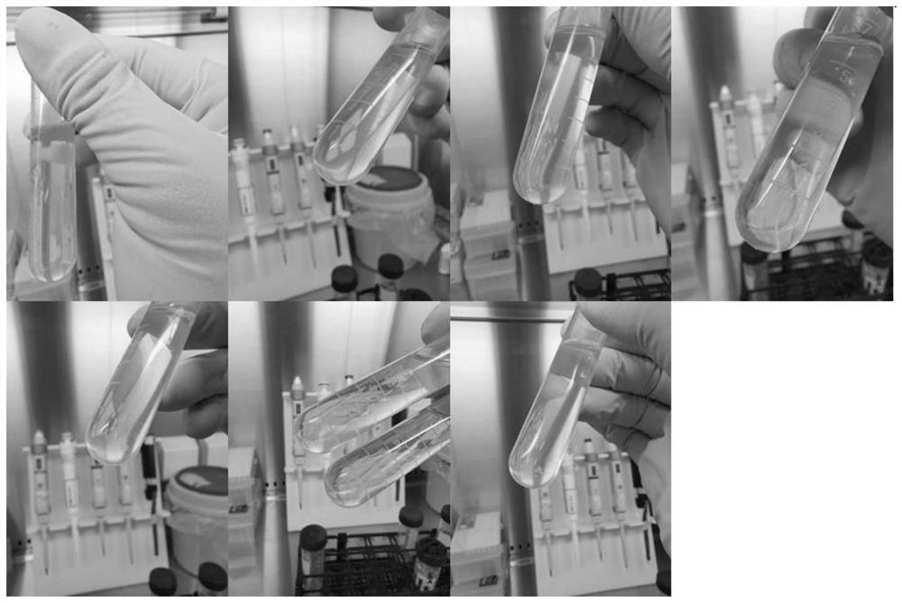 Urine exosome RNA extraction and library construction method for NGS platform