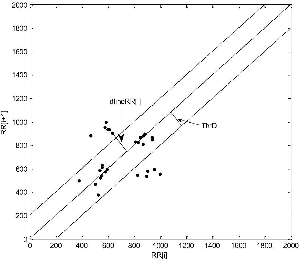 Atrial fibrillation detecting method and system