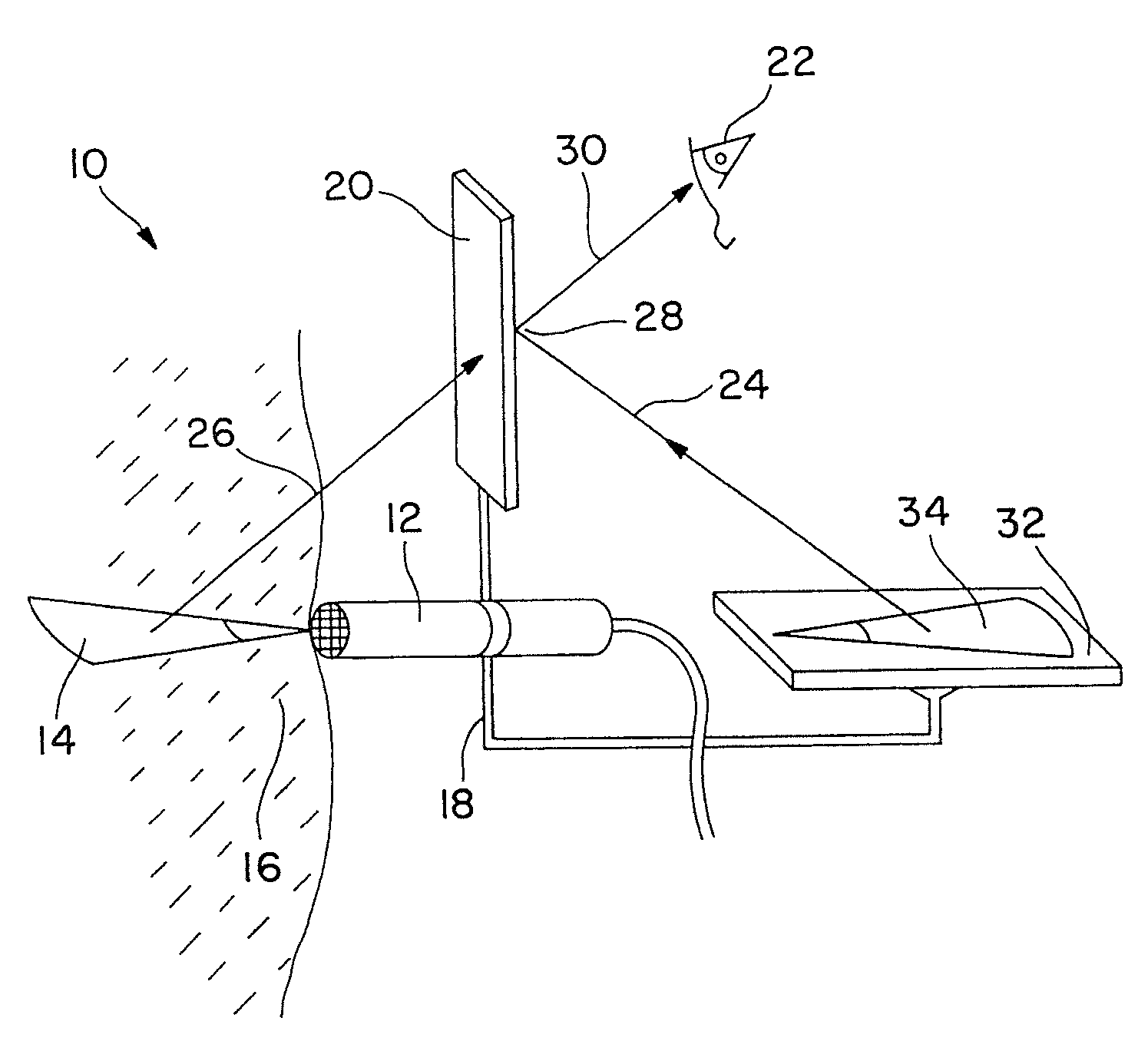 System for remote guidance by expert for imaging device