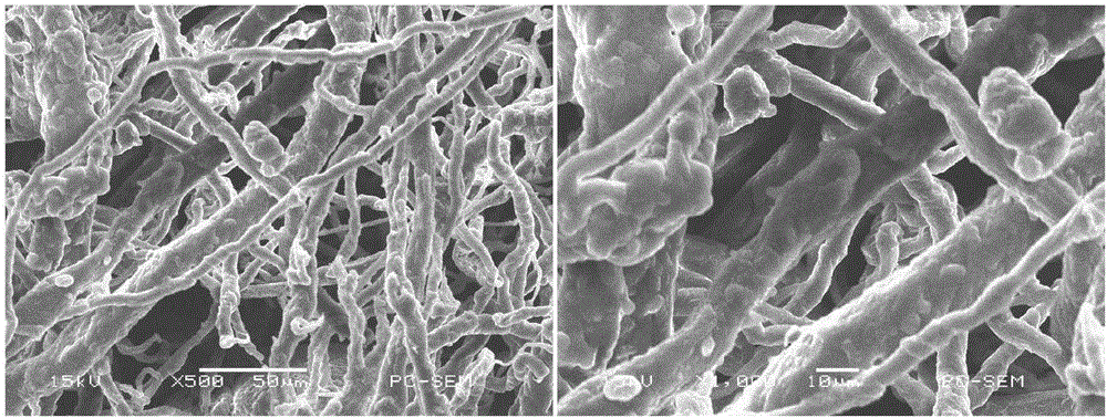 Preparation method of acellular matrix gels and acellular matrix gels