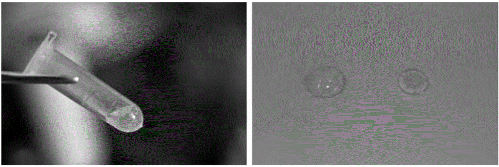 Preparation method of acellular matrix gels and acellular matrix gels