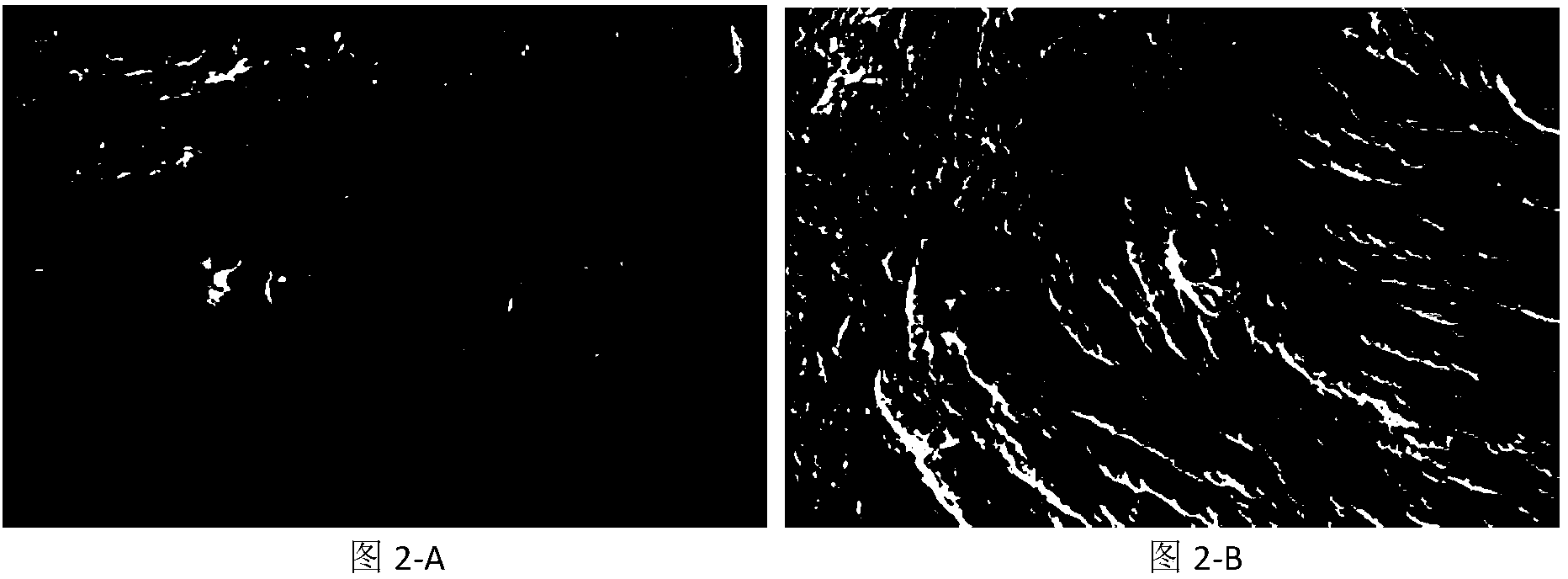 Antigen-removing biological bone and preparation method thereof