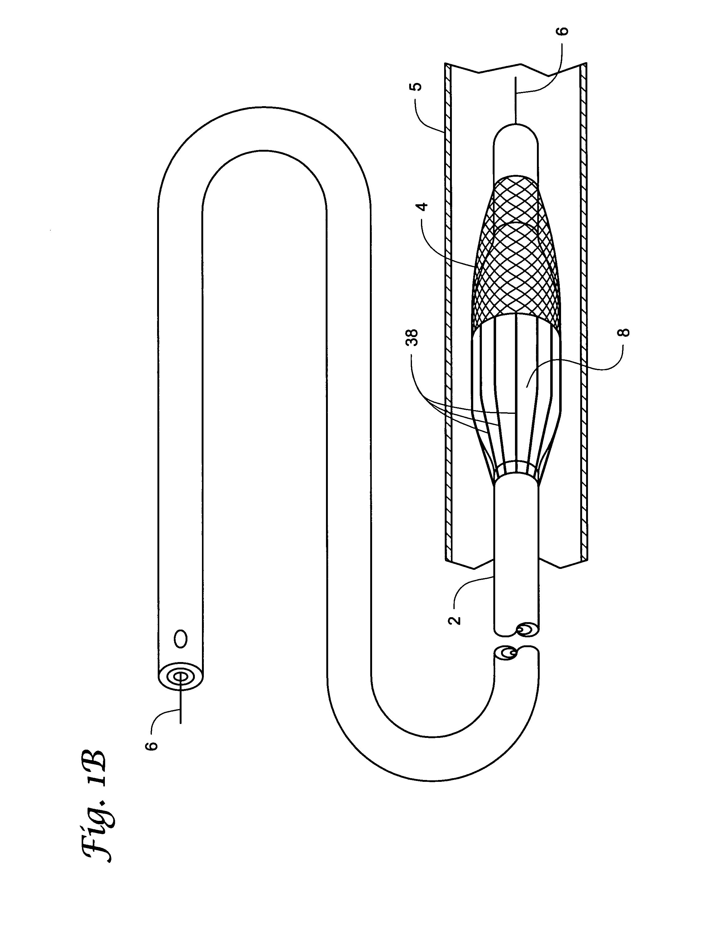 Medical device and method of intravenous filtration