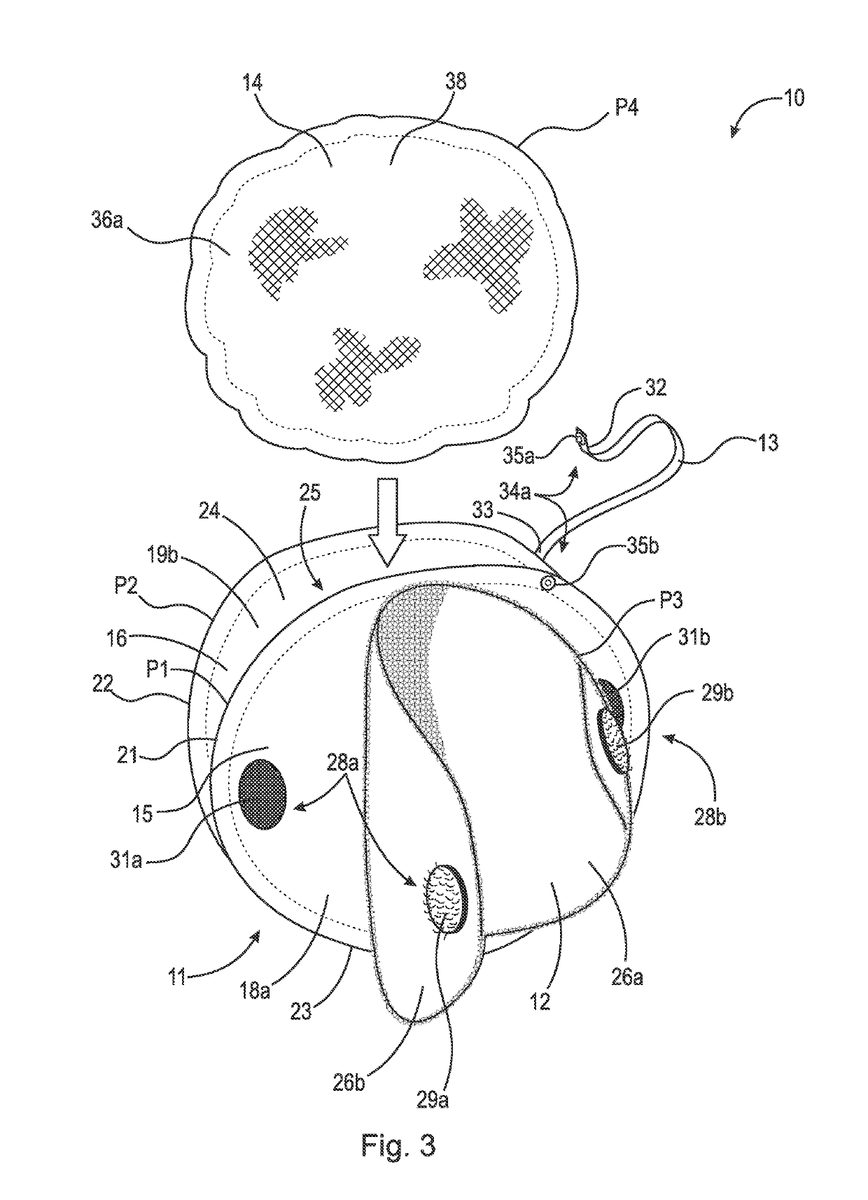 Thermal device for treating breastfeeding conditions