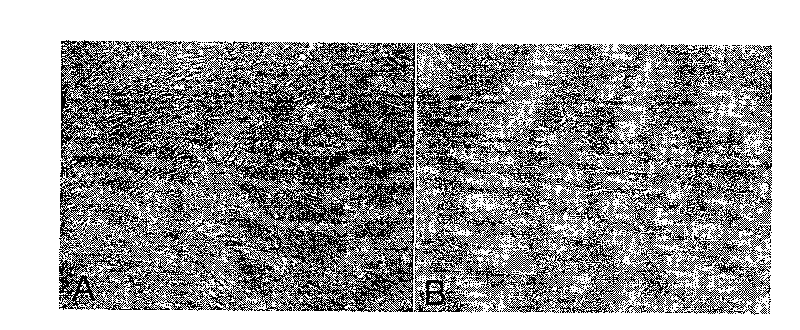 Artificial crystal with antiproliferous medicine coating for preventing and treating after-cataract forming