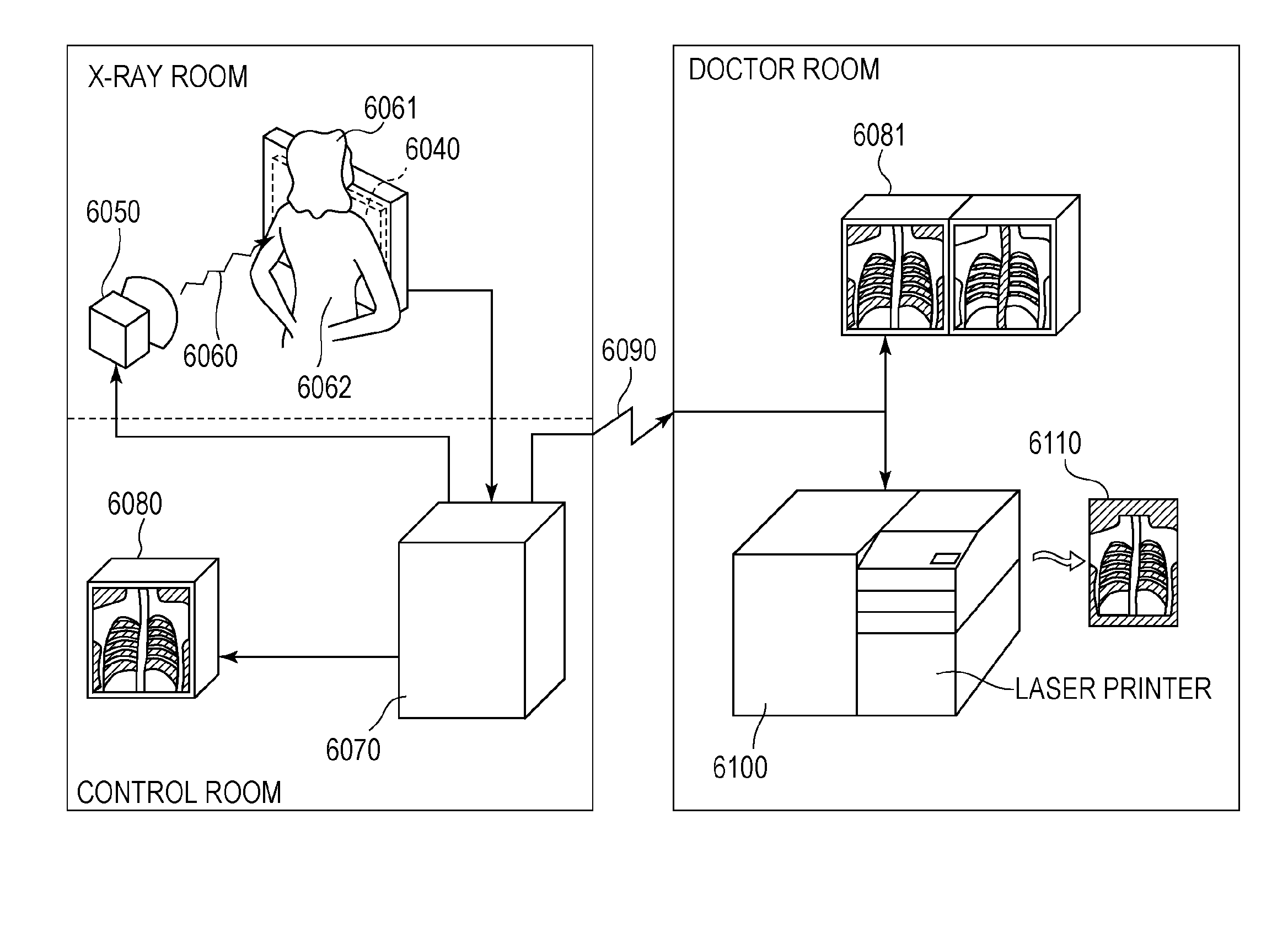 Radiation detection apparatus and radiation detection system