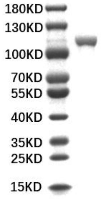 Method for detecting cardiac troponin I based on CRISPR Cas13d