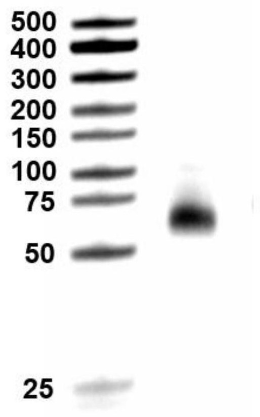 Method for detecting cardiac troponin I based on CRISPR Cas13d