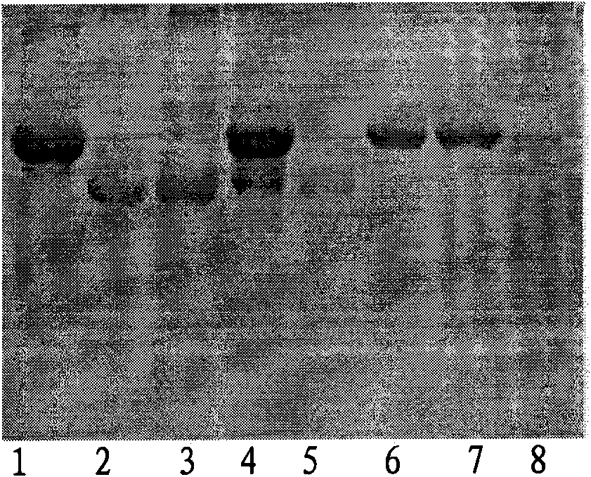 Immunomagnetic microparticle based on yelk antibody as well as preparation method and application of immunomagnetic nanoparticle