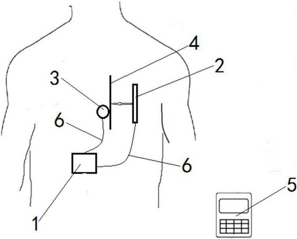 Sacral-nerve stimulator adjusting electric field direction