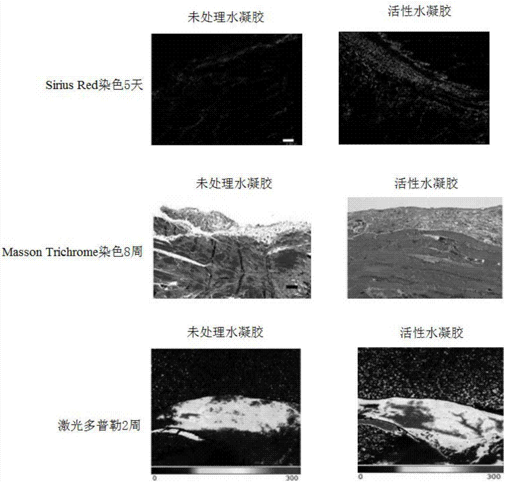 Active hydrogel, preparation method and application thereof in operative wound healing