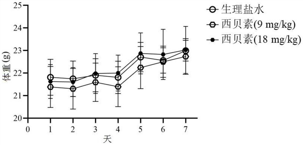 Application of sipeimine in preparation of medicines for preventing and/or treating ulcerative colitis