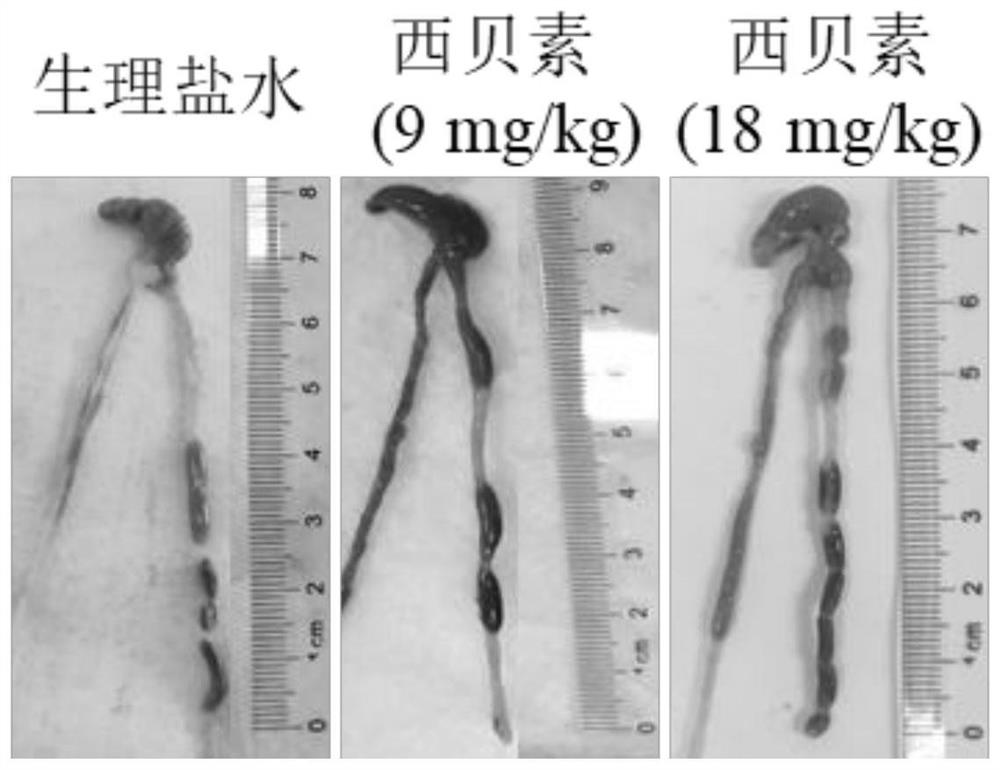 Application of sipeimine in preparation of medicines for preventing and/or treating ulcerative colitis