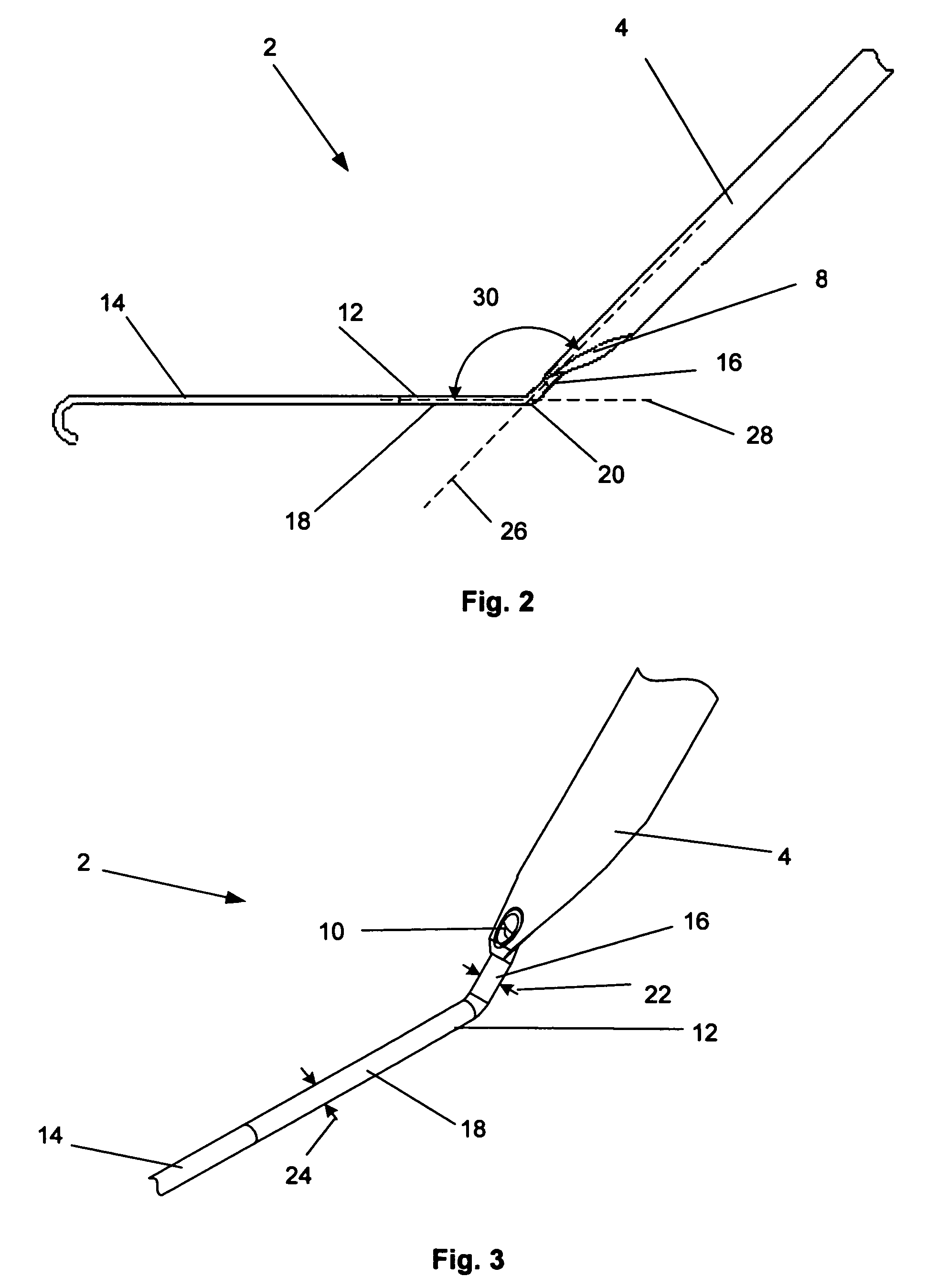 Access and closure device and method