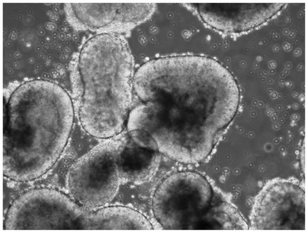 A method for cryopreservation and recovery of three-dimensional retinal tissue