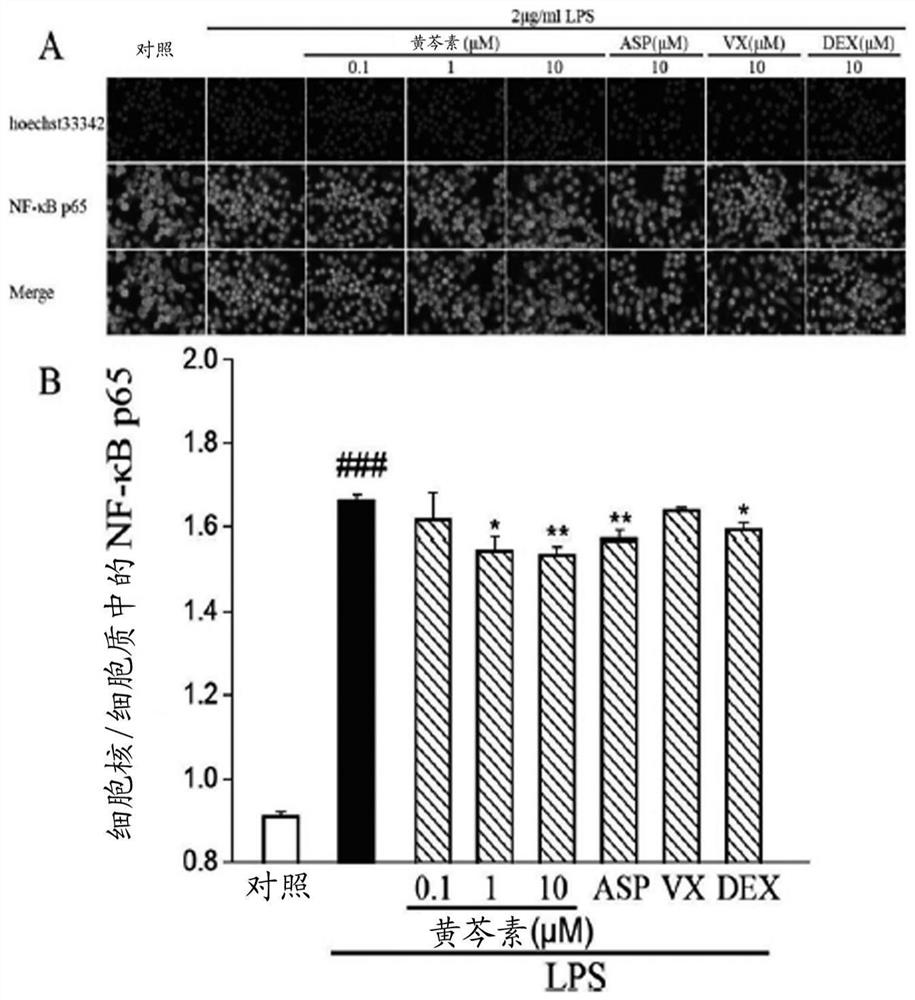 Application of baicalein in preparation of drugs for preventing and/or treating diseases caused by novel coronavirus infection