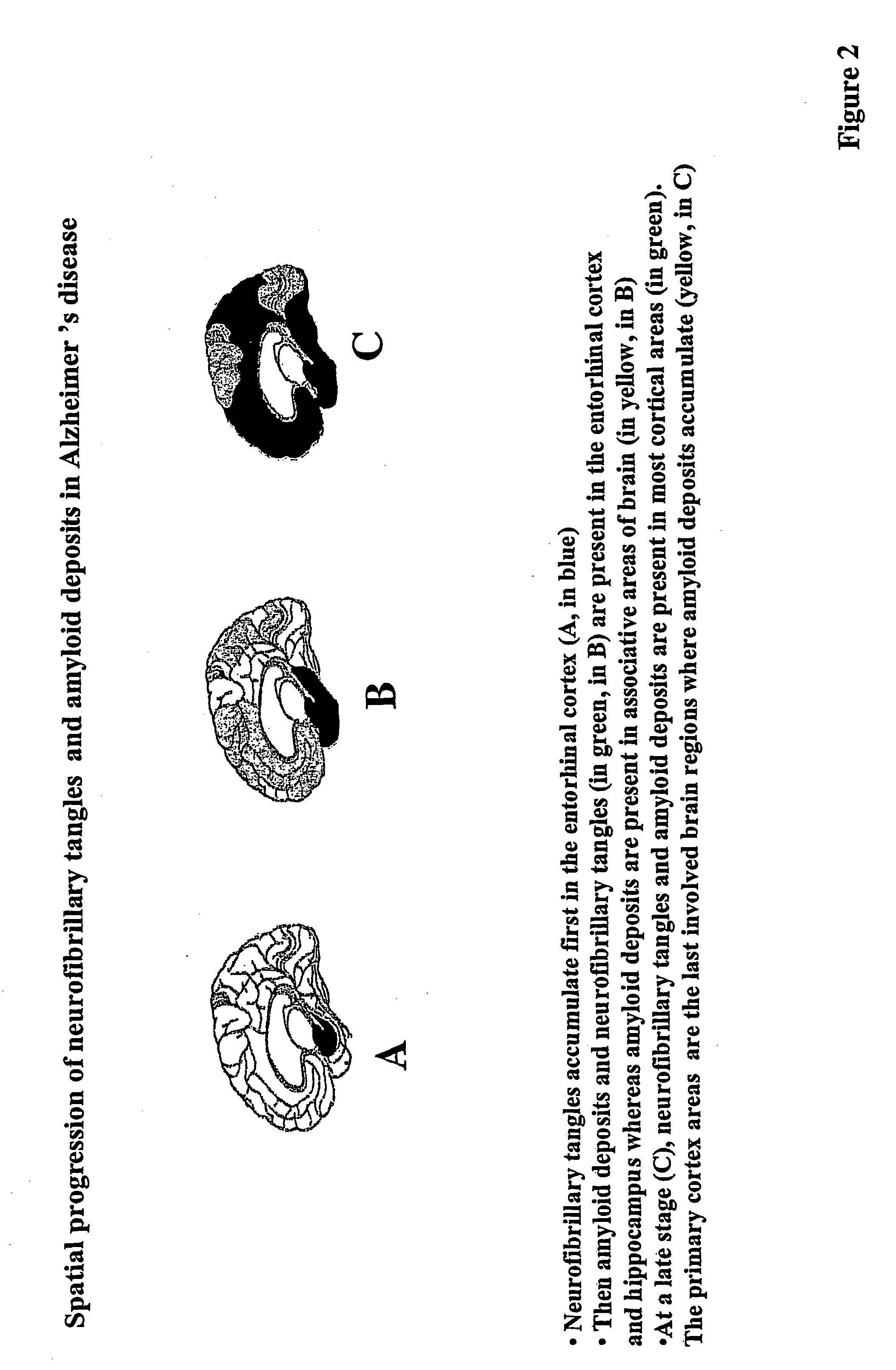 Methods of administering vectors to synaptically connected neurons