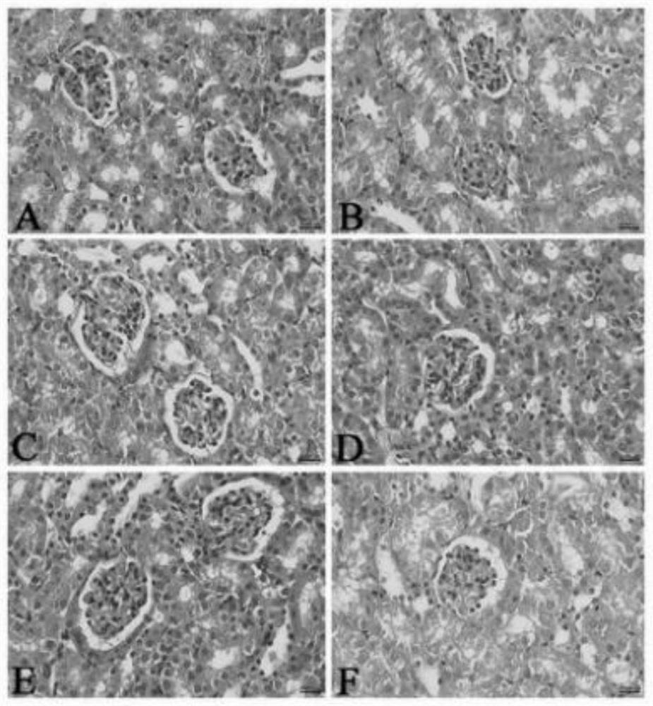 Traditional Chinese medicine composition for treating nephrotic syndrome as well as preparation method and application of traditional Chinese medicine composition