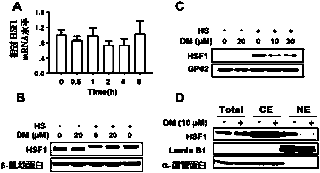 Inhibitor of heat shock factor 1, and preparation method and application of inhibitor