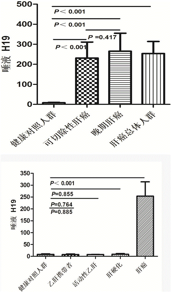 Liver cancer diagnosing reagent and kit using saliva as detection samples