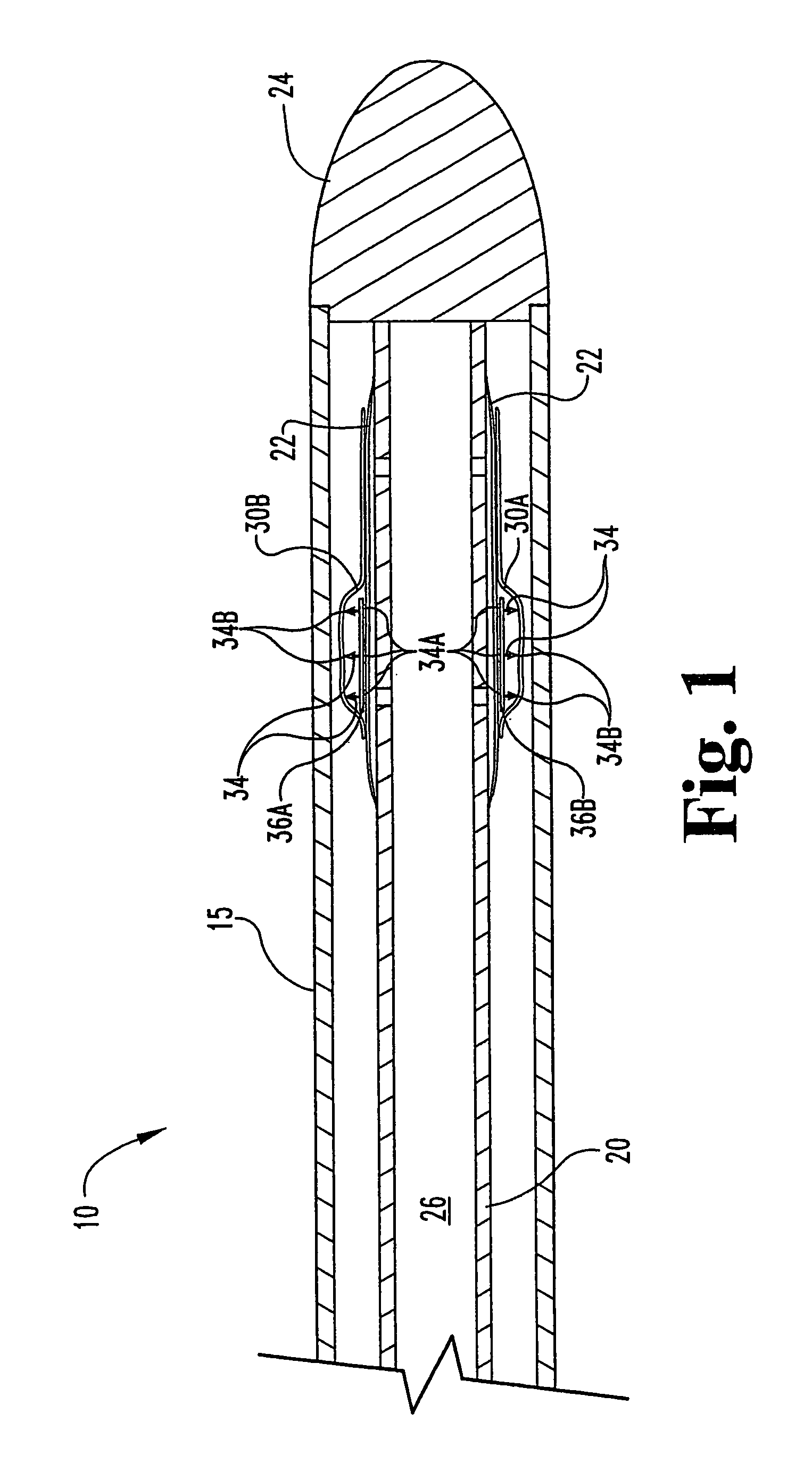 Methods and devices for the endoluminal deployment and securement of prostheses