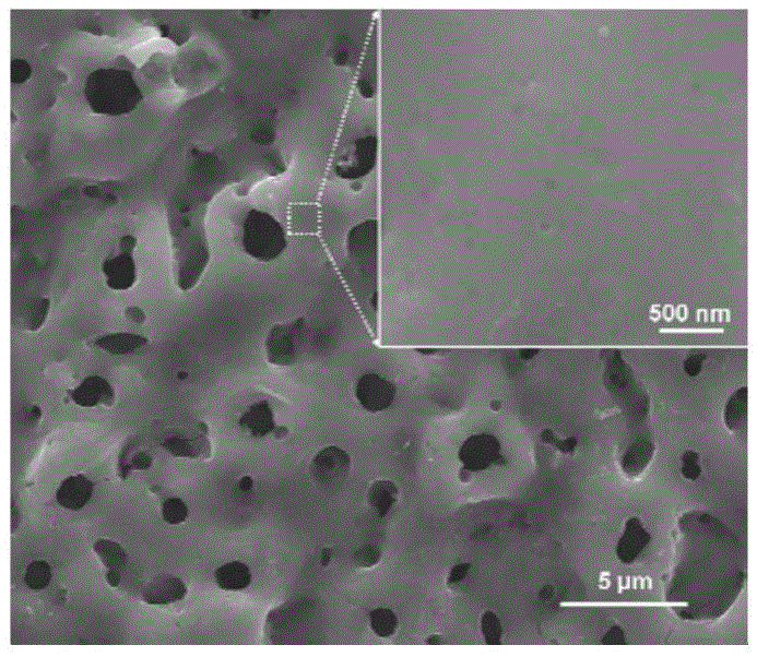 Zinc titanate-titanium oxide composite antibacterial coating on surface of titanium and preparation method of zinc titanate-titanium oxide composite antibacterial coating