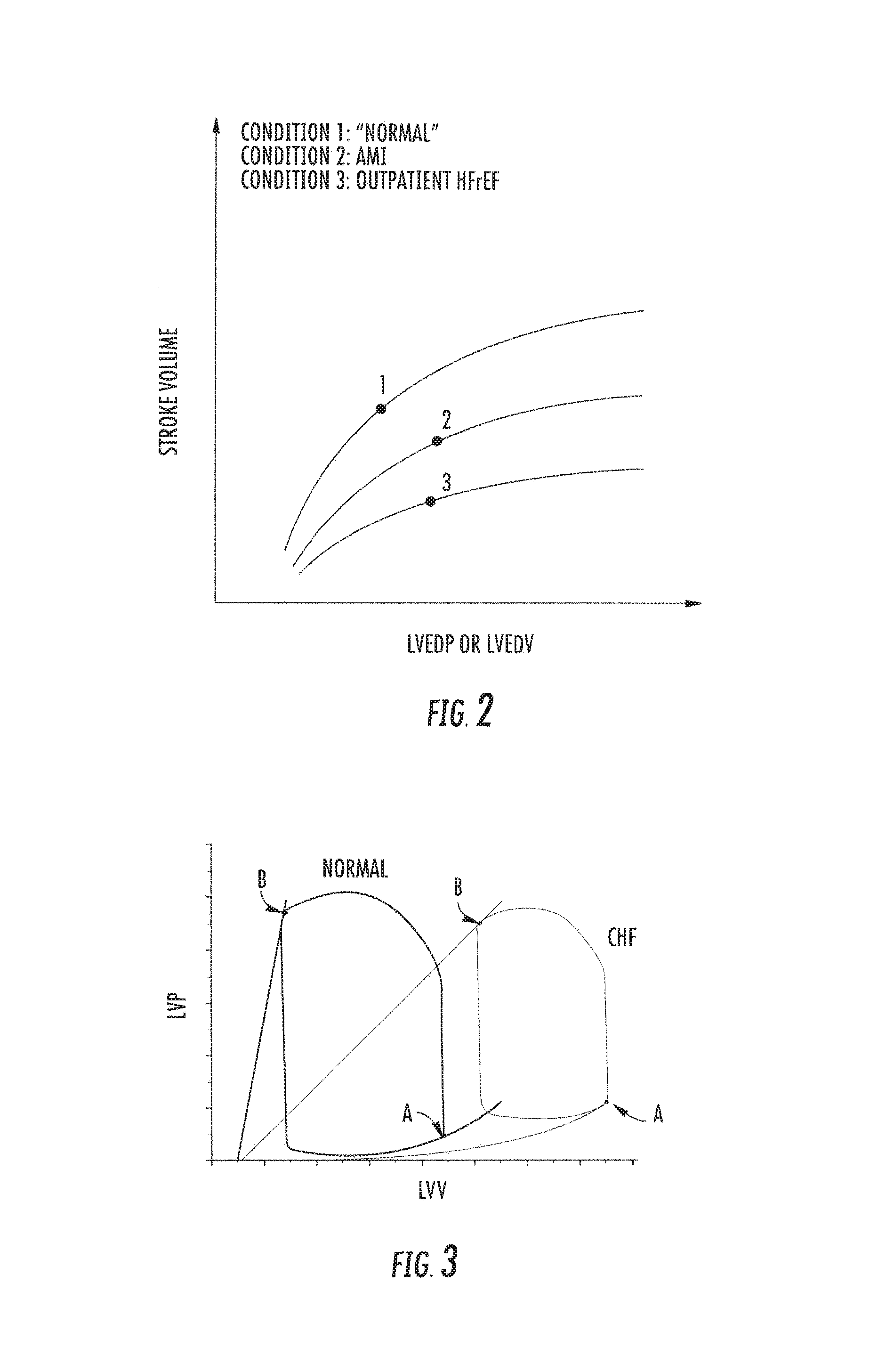 Systems and methods for treating acute and chronic heart failure