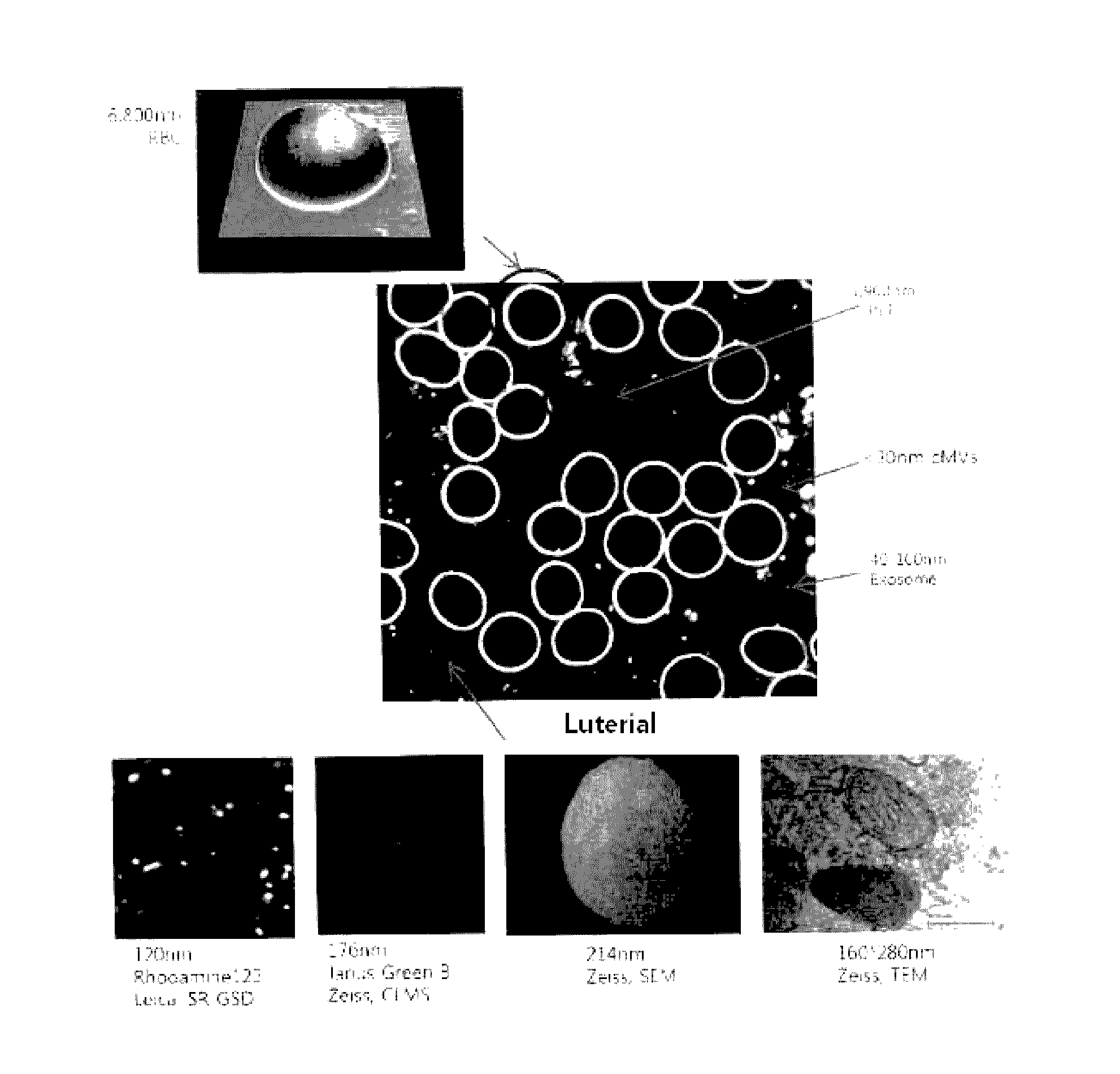 Method for screening cancer prevention agent or anticancer agent using morphological characteristics of luterial