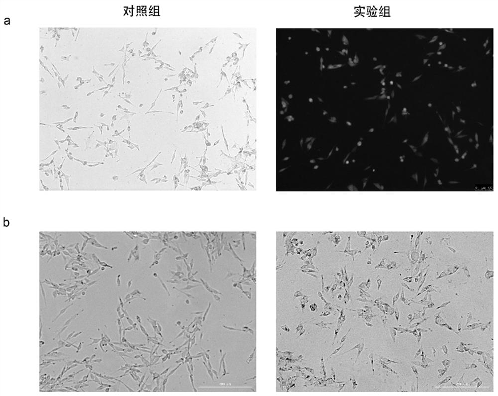 Molecular marker for diagnosing leucoderma diseases and application of thereof