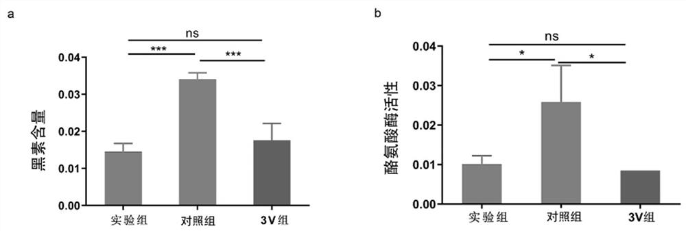 Molecular marker for diagnosing leucoderma diseases and application of thereof