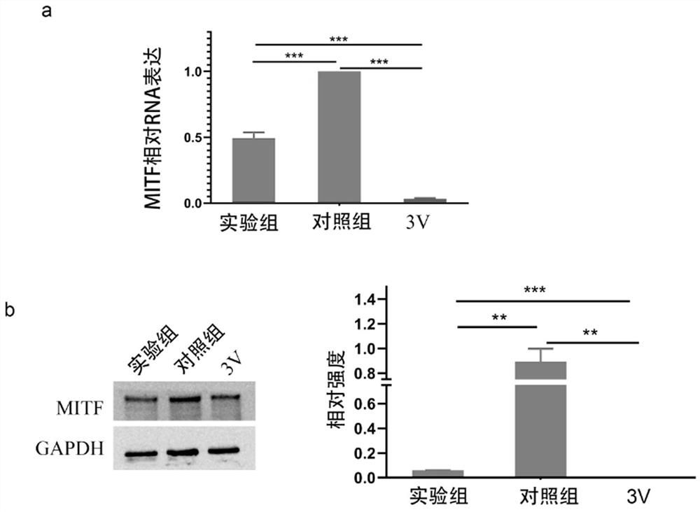 Molecular marker for diagnosing leucoderma diseases and application of thereof