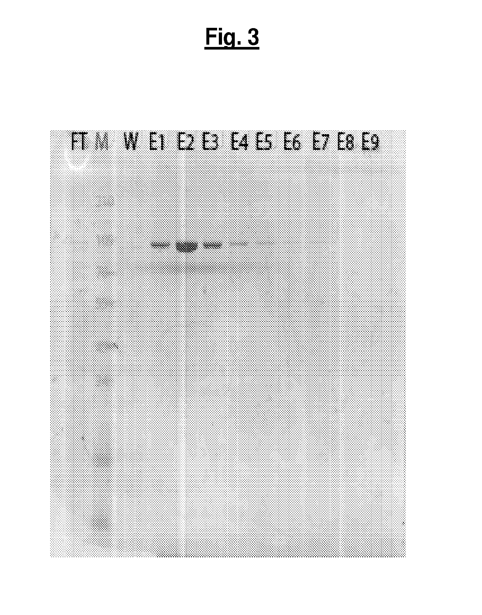 Compositions and methods for treating pathological calcification and ossification