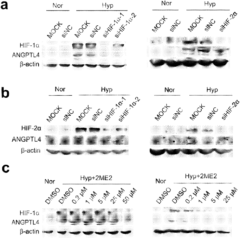 ANGPTL4 as marker of hypoxia detection and application thereof