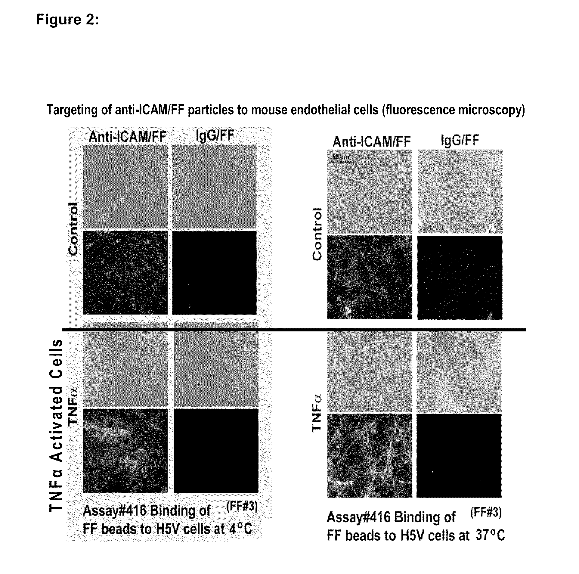 Imaging of Activated Vascular Endothelium Using Immunomagnetic MRI Contrast Agents