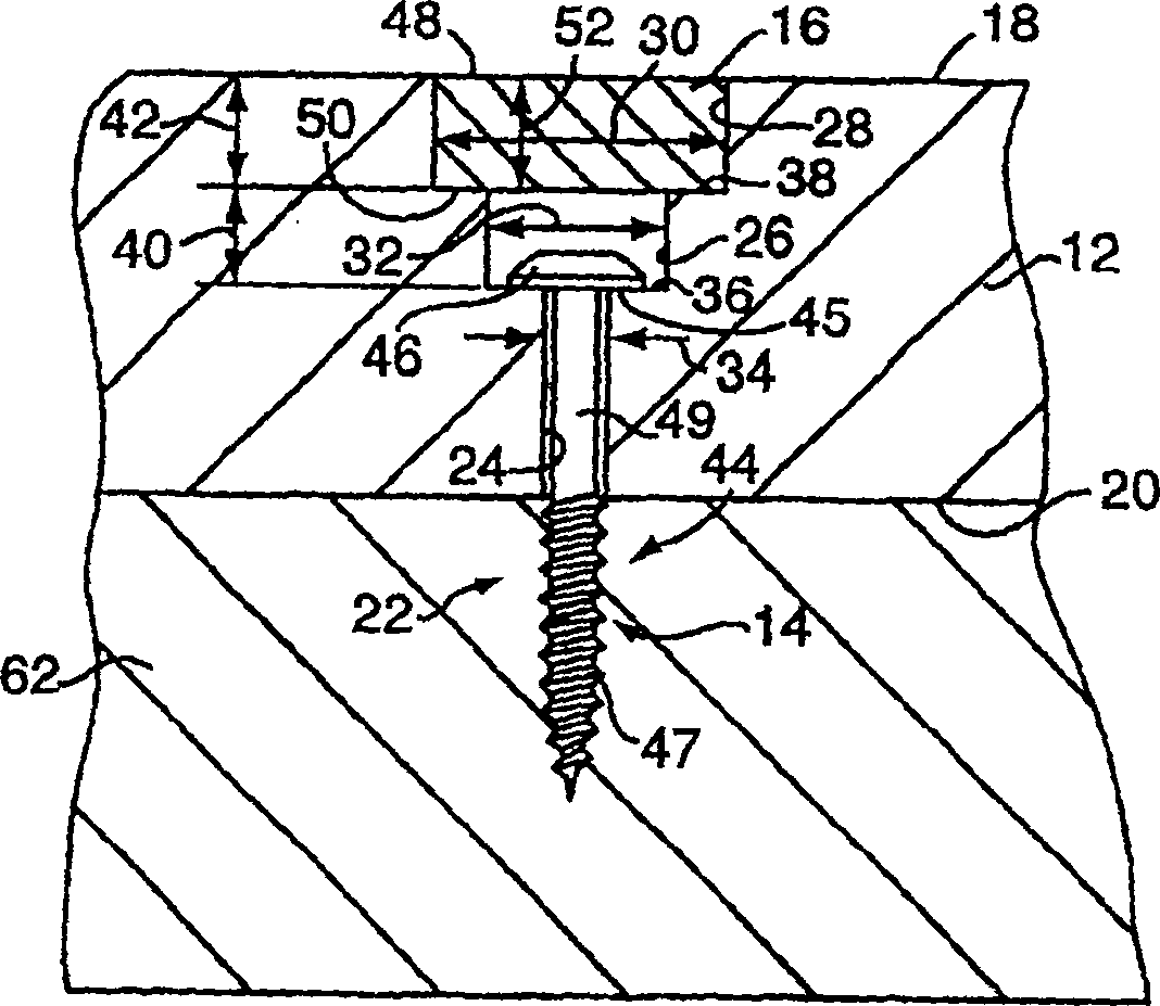 Bowling alley device