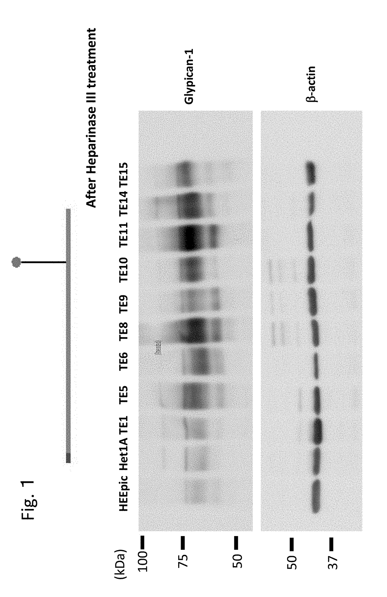 Esophageal cancer marker and use thereof