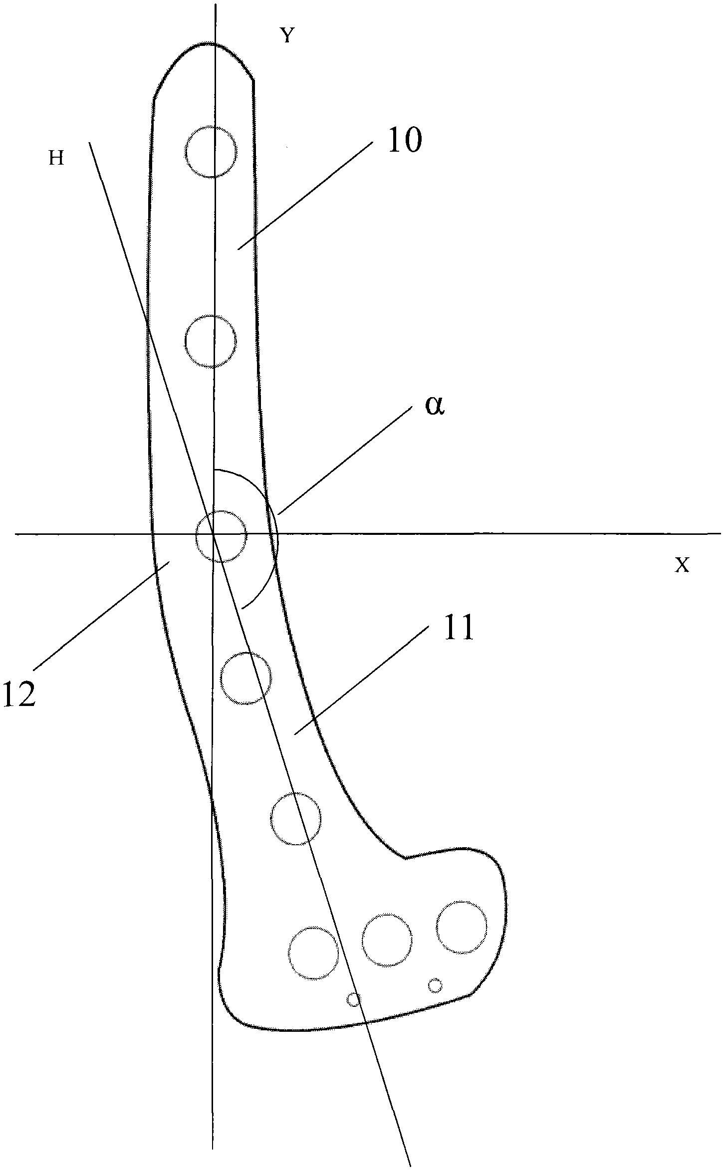 Clinical type bone plate for distal humeral fracture