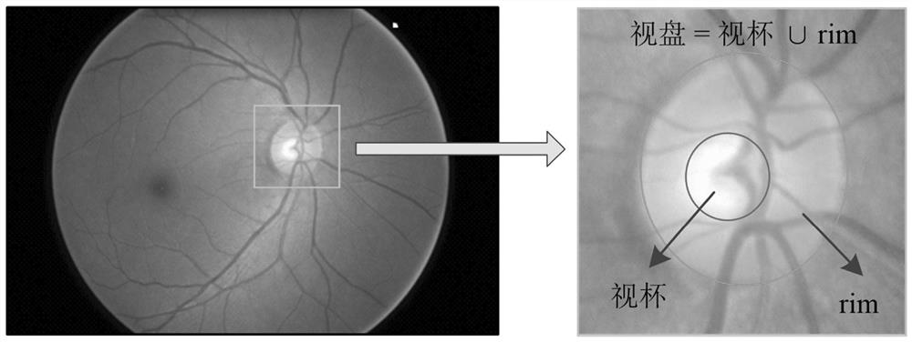 Optic cup and optic disk segmentation method based on rich context network