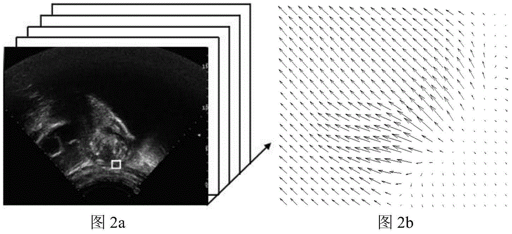 Extraction method of vascular perfusion area in contrast-enhanced ultrasound images based on brox optical flow method