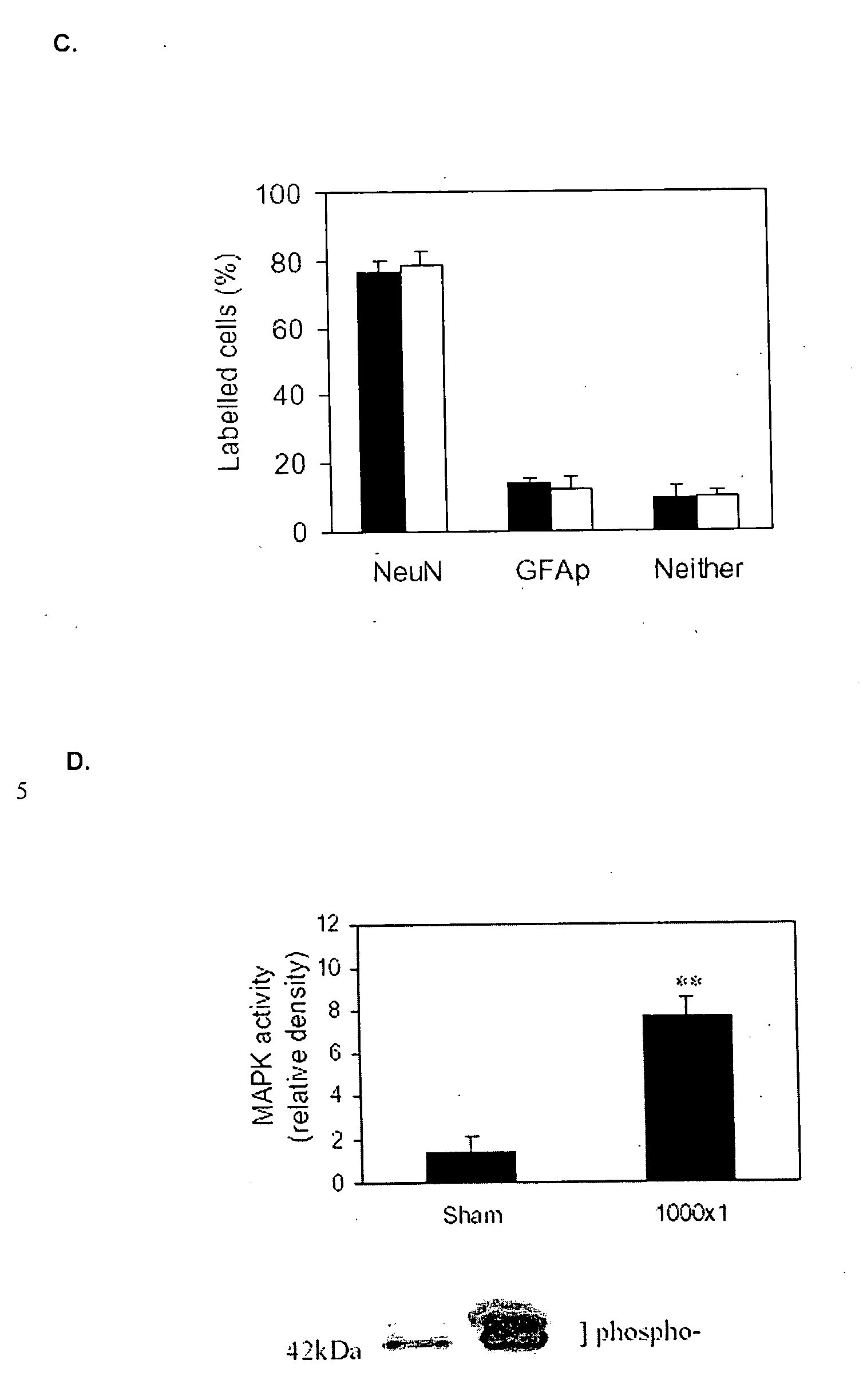 Use of transcranial magnetic stimulation to improve memory and stress related syndromes in humans