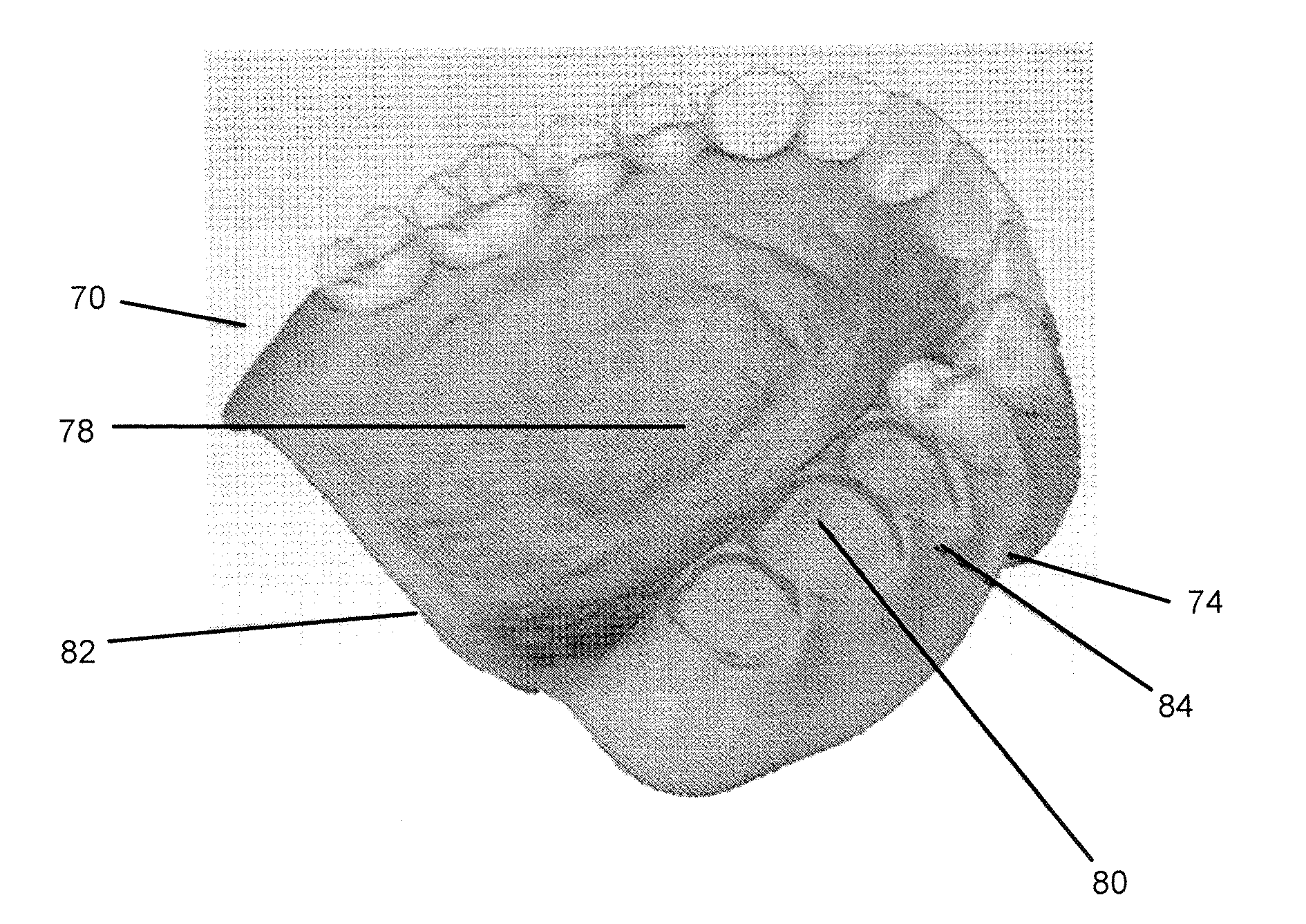 Systems and processes for forming anatomical features in dentures