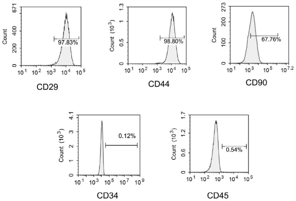 Application of extracellular vesicles in preparation of preparation for treating or preventing metabolic inflammatory syndrome diseases