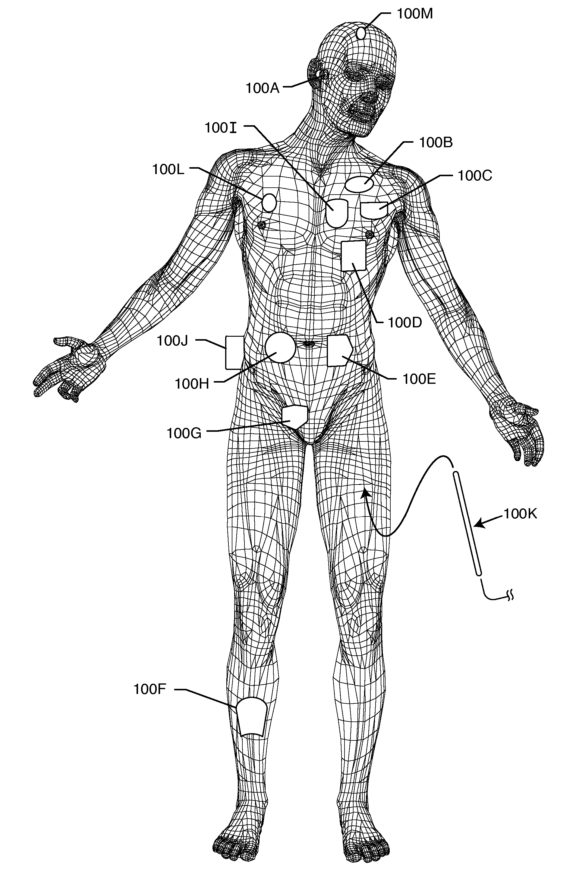 Tank filters utilizing very low K materials, in series with lead wires or circuits of active medical devices to enhance MRI compatibility