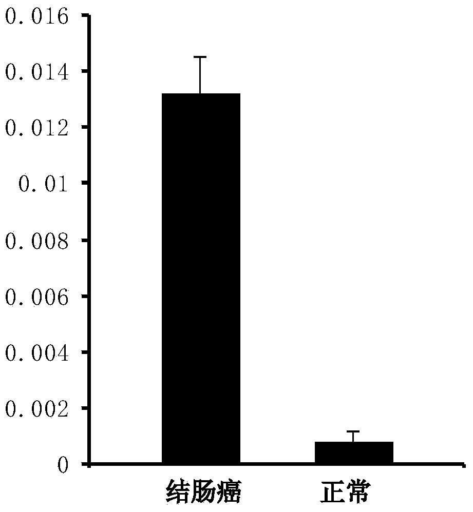 Tumor marker and application thereof to preparation of colorectal cancer diagnostic reagent