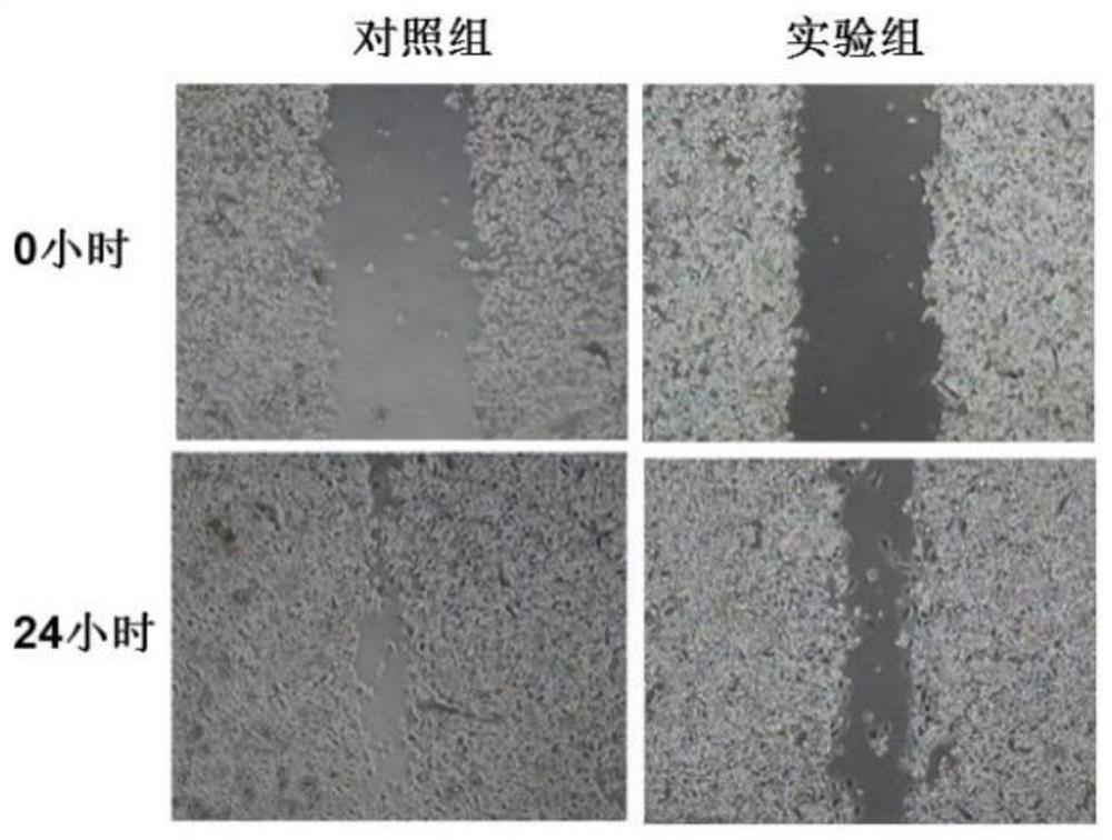 A traditional Chinese medicine compound preparation for treating erbb2 positive gastric cancer and preparation method thereof