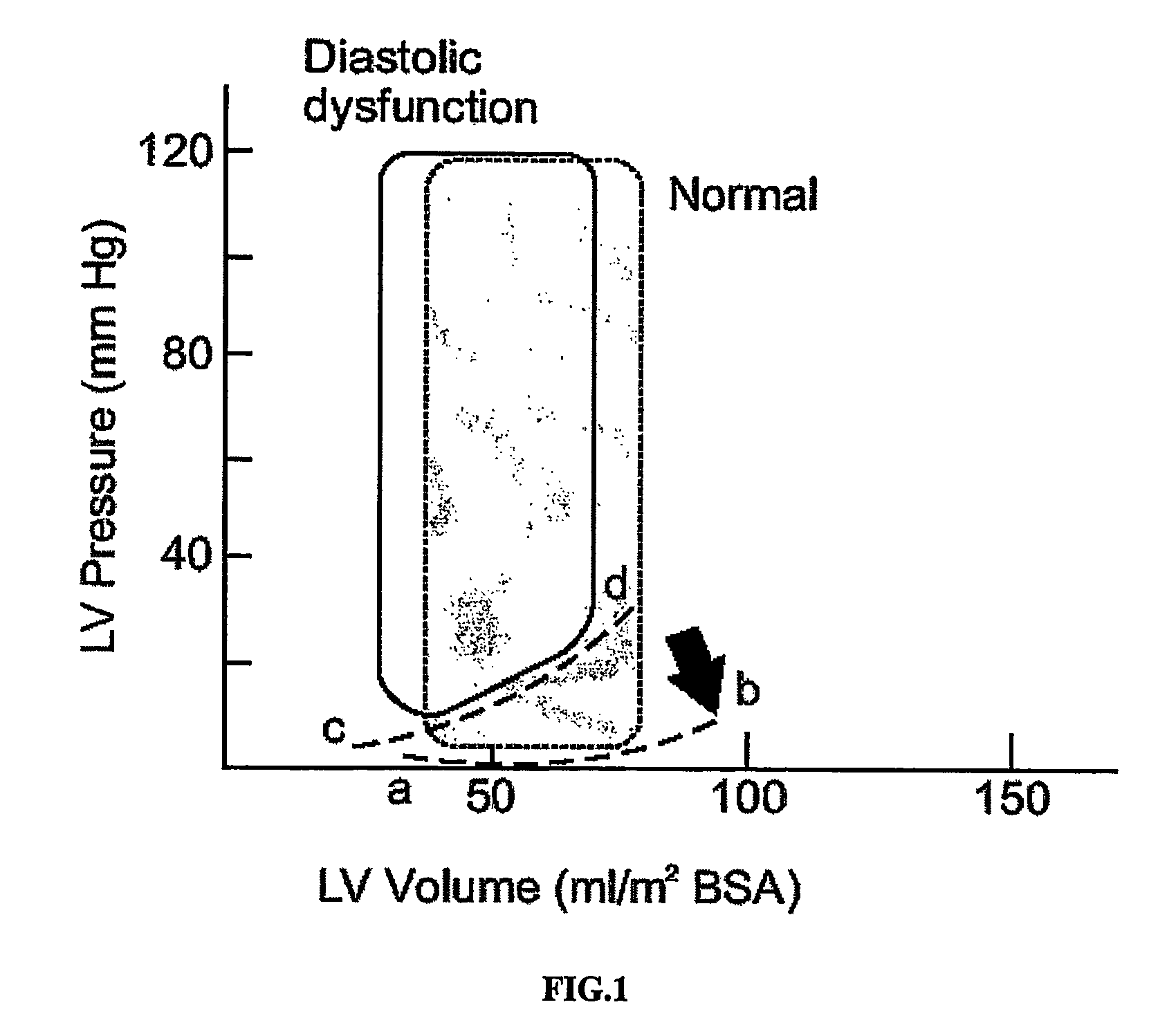 In vivo for improving diastolic ventricular function