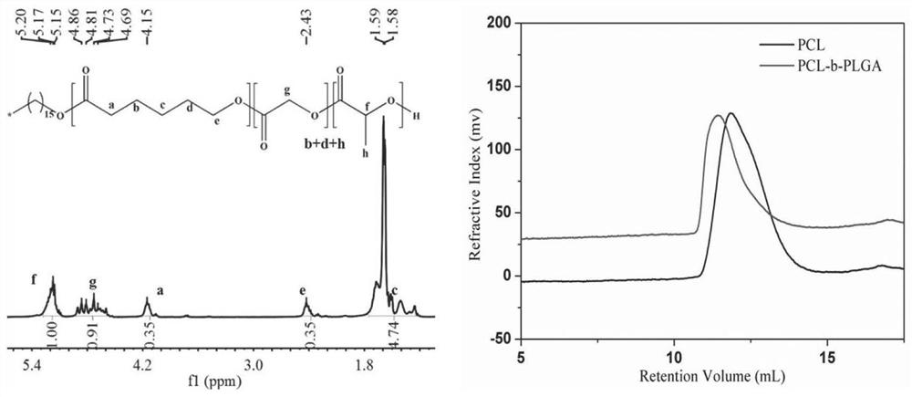 Local long-acting drug release system for bone disease treatment, and preparation method and application thereof