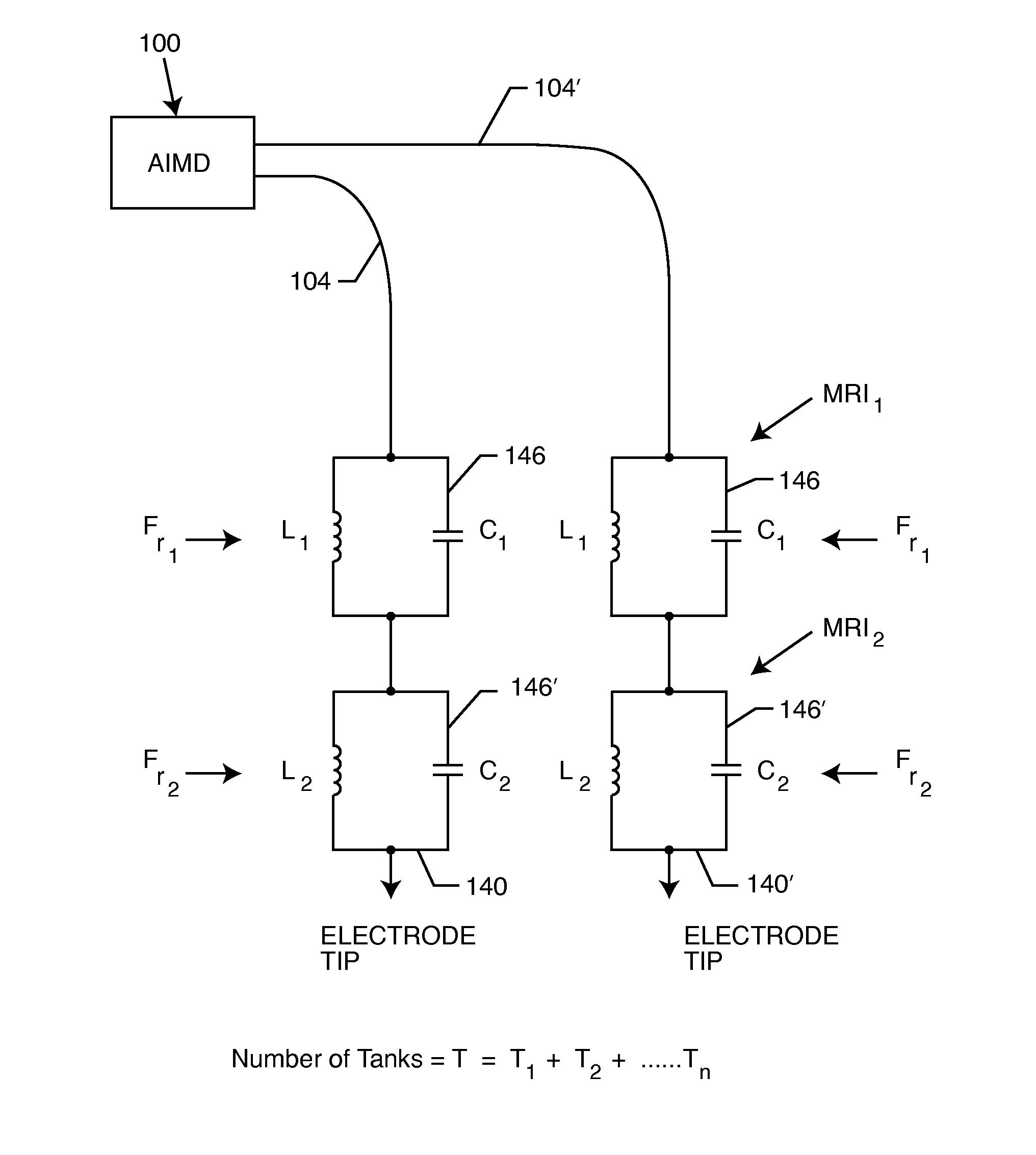 Integrated tank filter for a medical therapeutic device