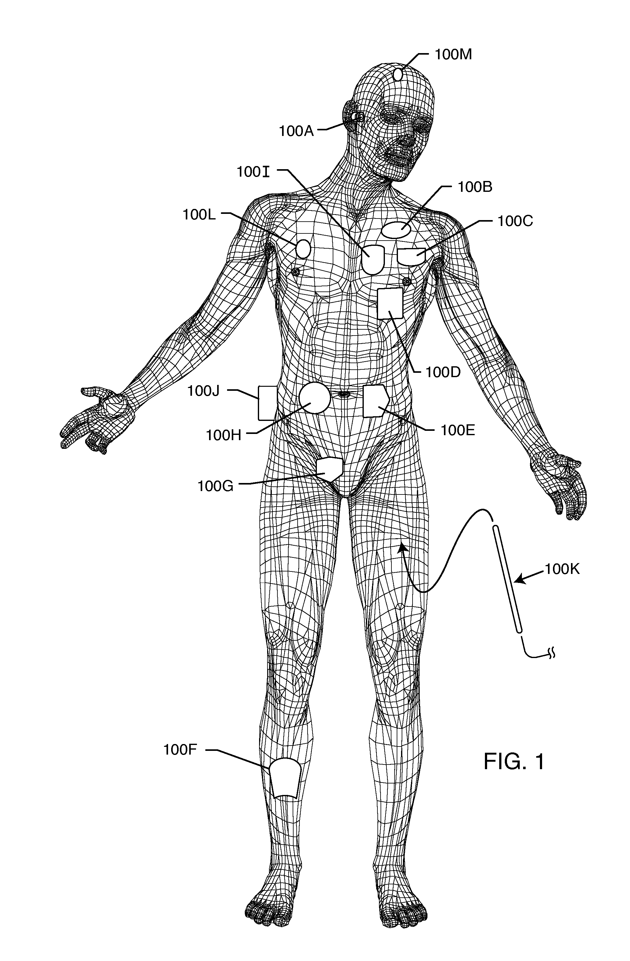 Integrated tank filter for a medical therapeutic device